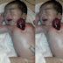 (WARNING: GRAPHIC PHOTOS) Baby Born Breathing with Her Heart Outside Of Her Chest