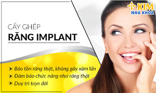 Tiêu Chí Quyết Định Cấy Ghép Răng Implant Ở Đâu Tốt.