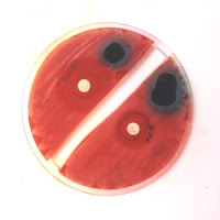 Οι αντιμικροβιακές και αντιπαρασιτικές ιδιότητες φλοιών καρυδιού Οι αντιμικροβιακές και αντιπαρασιτικές ιδιότητες των φλοιών καρυδιού