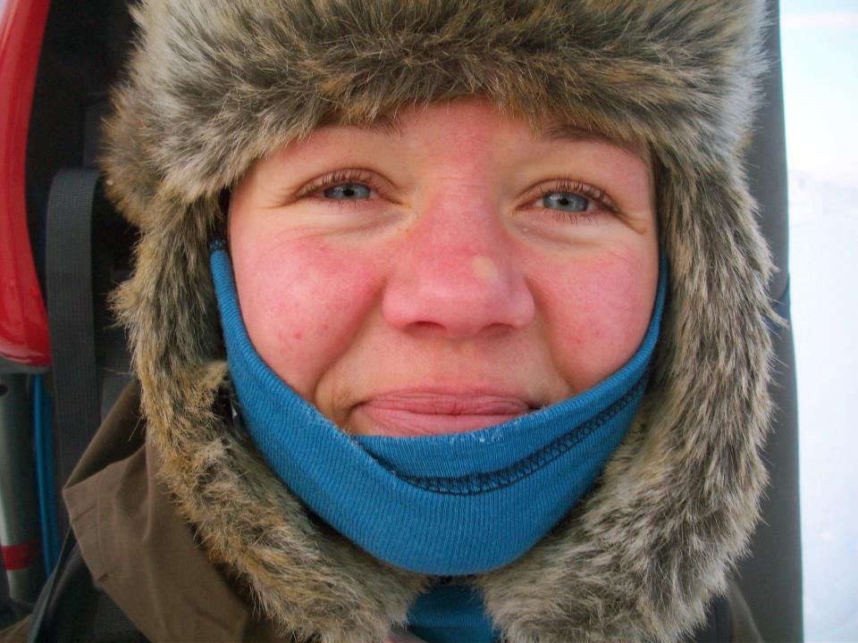 Førstehjelp på vinterfjellet- Frostskader
