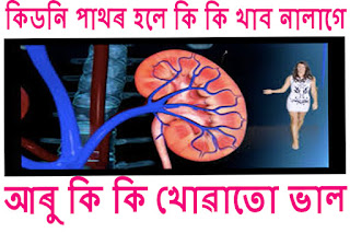 কিডনী-পাথৰ-হলে-কি-খাব-নালাগে