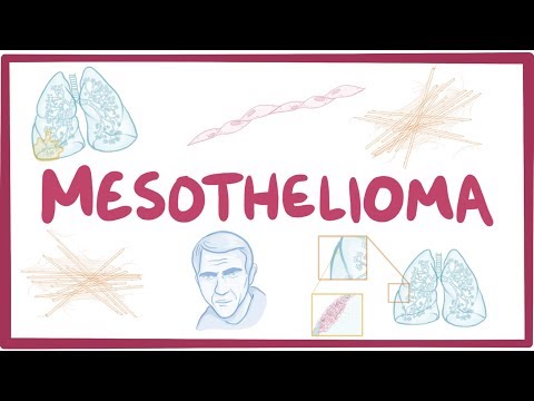 mesothelioma tumor regression