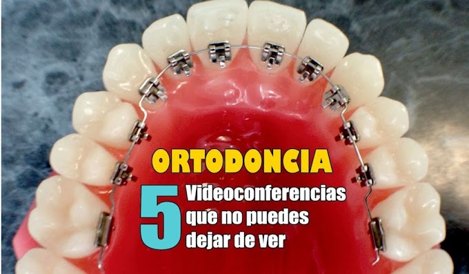 CURSO ORTODONCIA ONLINE: 5 Videoconferencias que no puedes dejar de ver