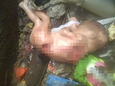 Tragis! Bayi Malang Ini Meninggal Karena Dimakan Tikus Raksasa Tragis! Bayi Malang Ini Meninggal Karena Dimakan Tikus Raksasa