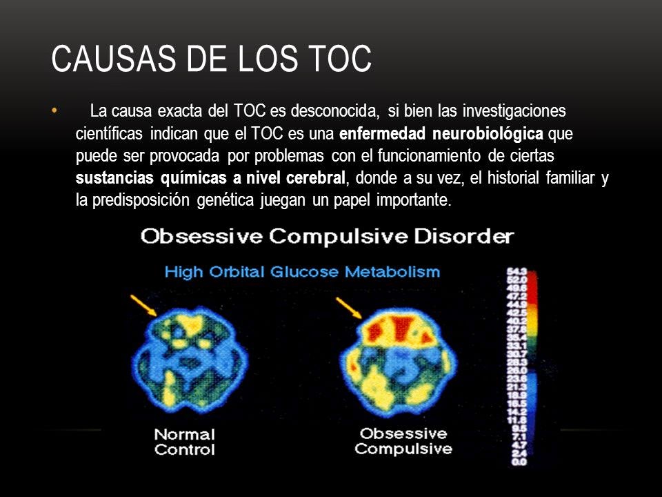 que es el trastorno obsesivo compulsivo de la personalidad que es el trastorno obsesivo compulsivo de la personalidad