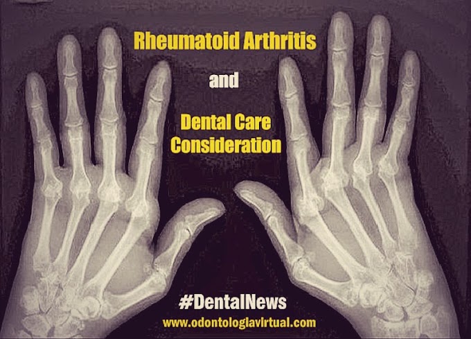 RHEUMATOID ARTHRITIS: Dental Care Consideration