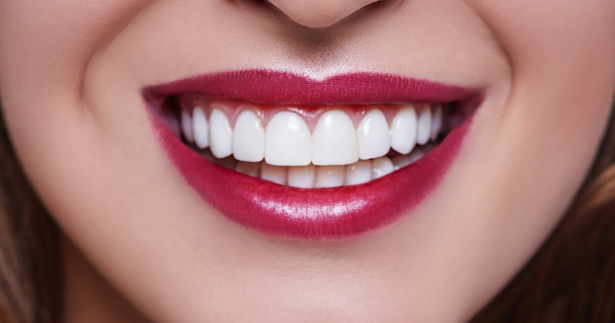 Regency Dental Group How Veneers, Crowns and Dental Implants Help Patients