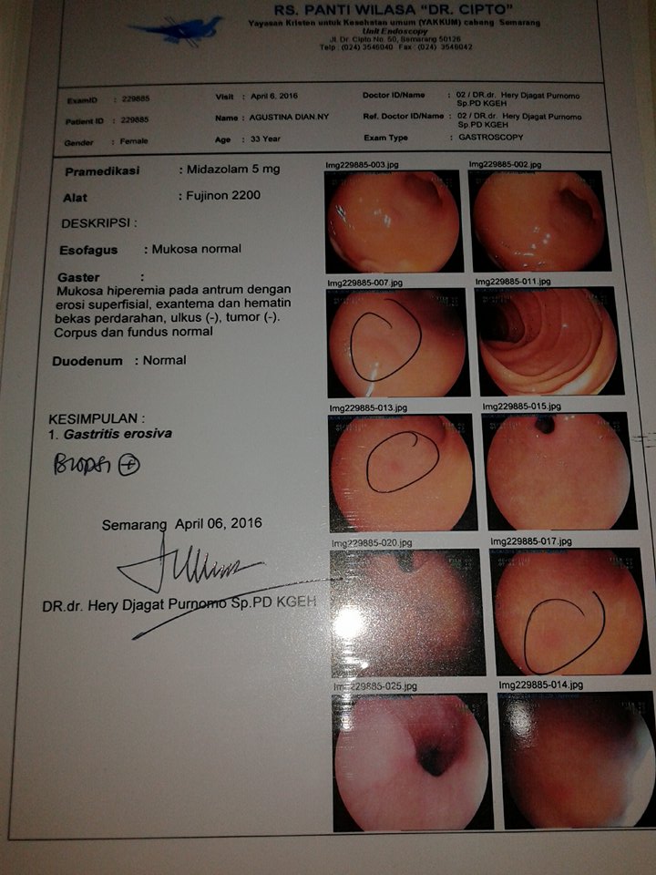 Susan's Blog Pengalaman Endoskopi di RS Panti Wilasa Dr. Cipto Semarang