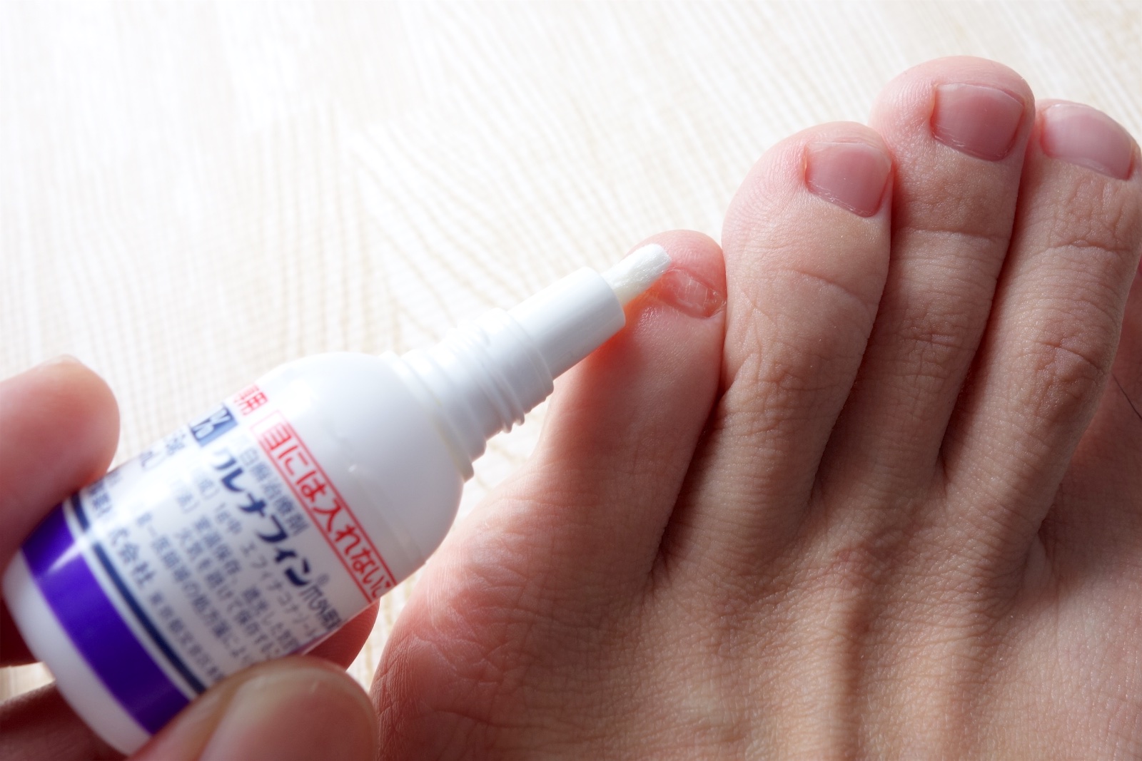 爪水虫を塗り薬クレナフィンだけで完治させる！ 爪水虫用の塗り薬「クレナフィン」