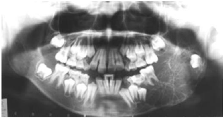 近期錯題測驗 牙醫學 四 包括口腔顎面外科學 牙科放射線學等科目及其相關臨床實例與醫學倫理 阿摩線上測驗
