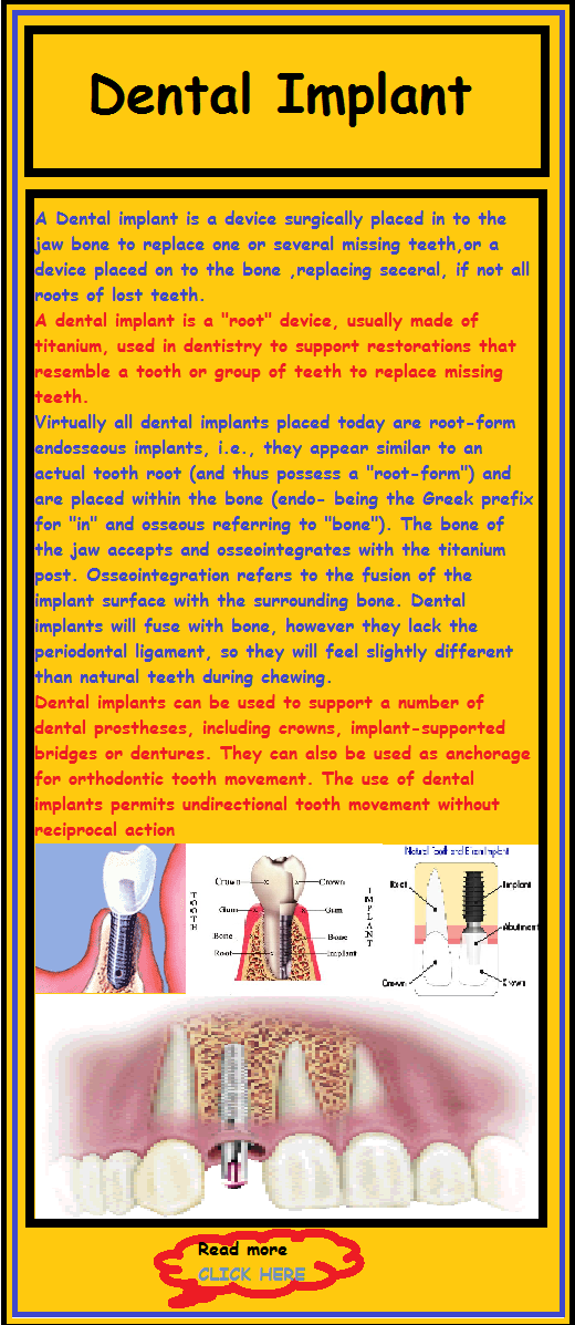Common Dental Problem And Solution Implant Dentistry