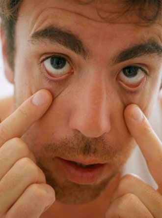 Natural Ways To Get Rid Of Black Circles Under Eyes Natural Ways To Get Rid Of Black Circles Under Eyes