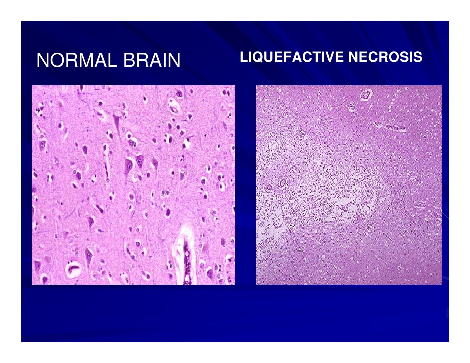 Lecture Notes in Medical Technology Lecture 2 Mechanism of Cell Damage