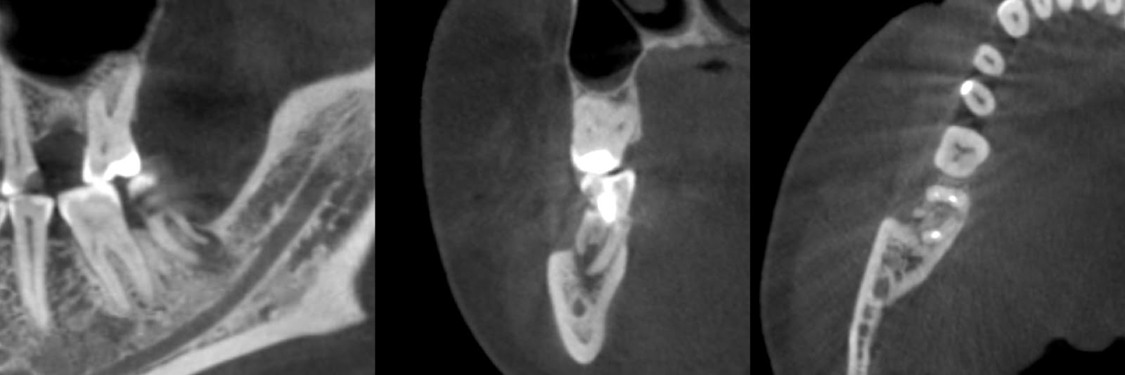 Кт-4 пневмония ковидная. Н 3 кт. 564кт3 аналог. Микросхема 564кт3. Компьютерная томография кт головного мозга.