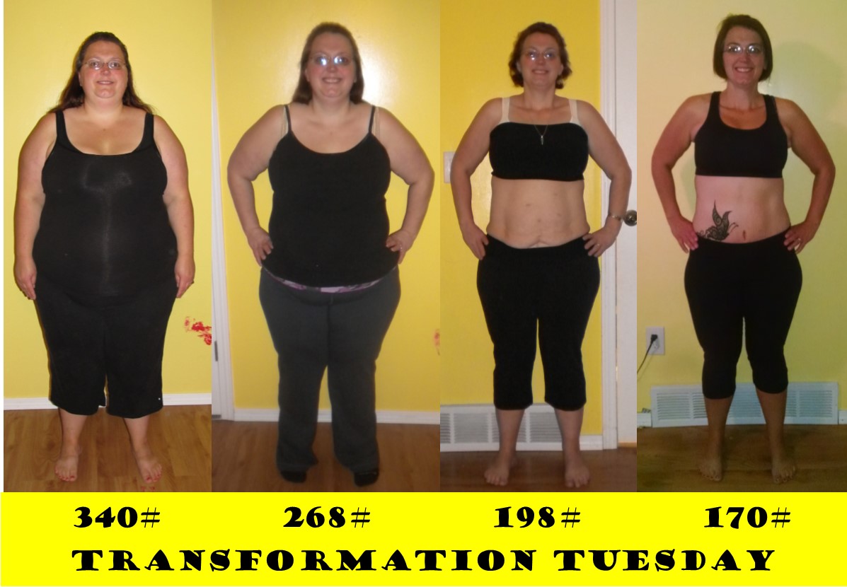 A Lesser Jen 3yr 9 mo Weight loss and 6 mo Tummy Tuck updates