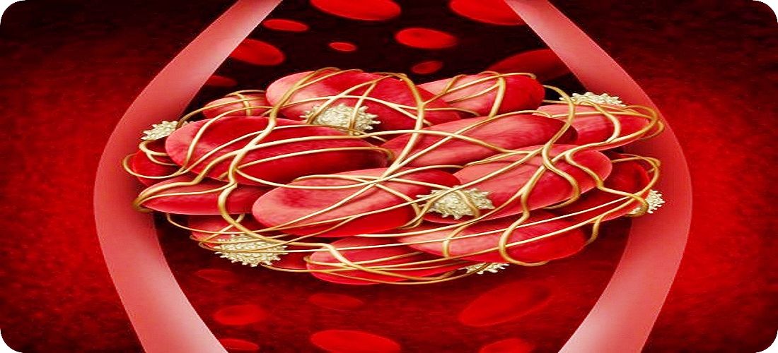 La homocisteina es factor de accidentes cardiovasculares homocisteina