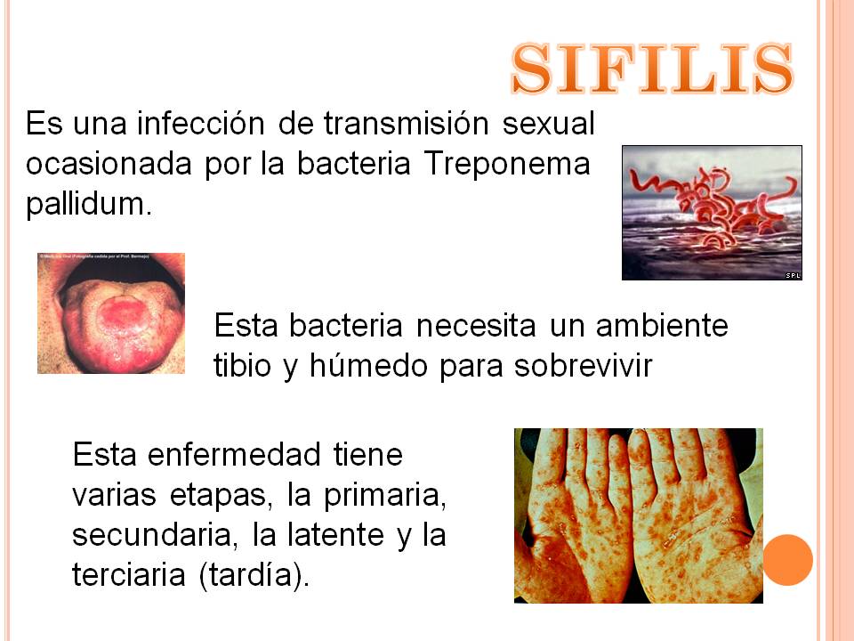 almanaque al dia ENFERMEDADES DE TRANSMISION SEXUAL
