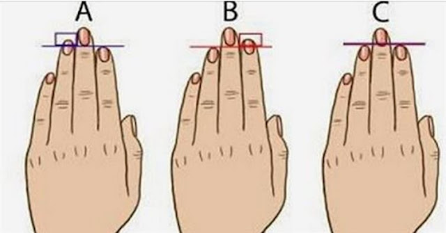 Les types morphologiques de la main et des pieds