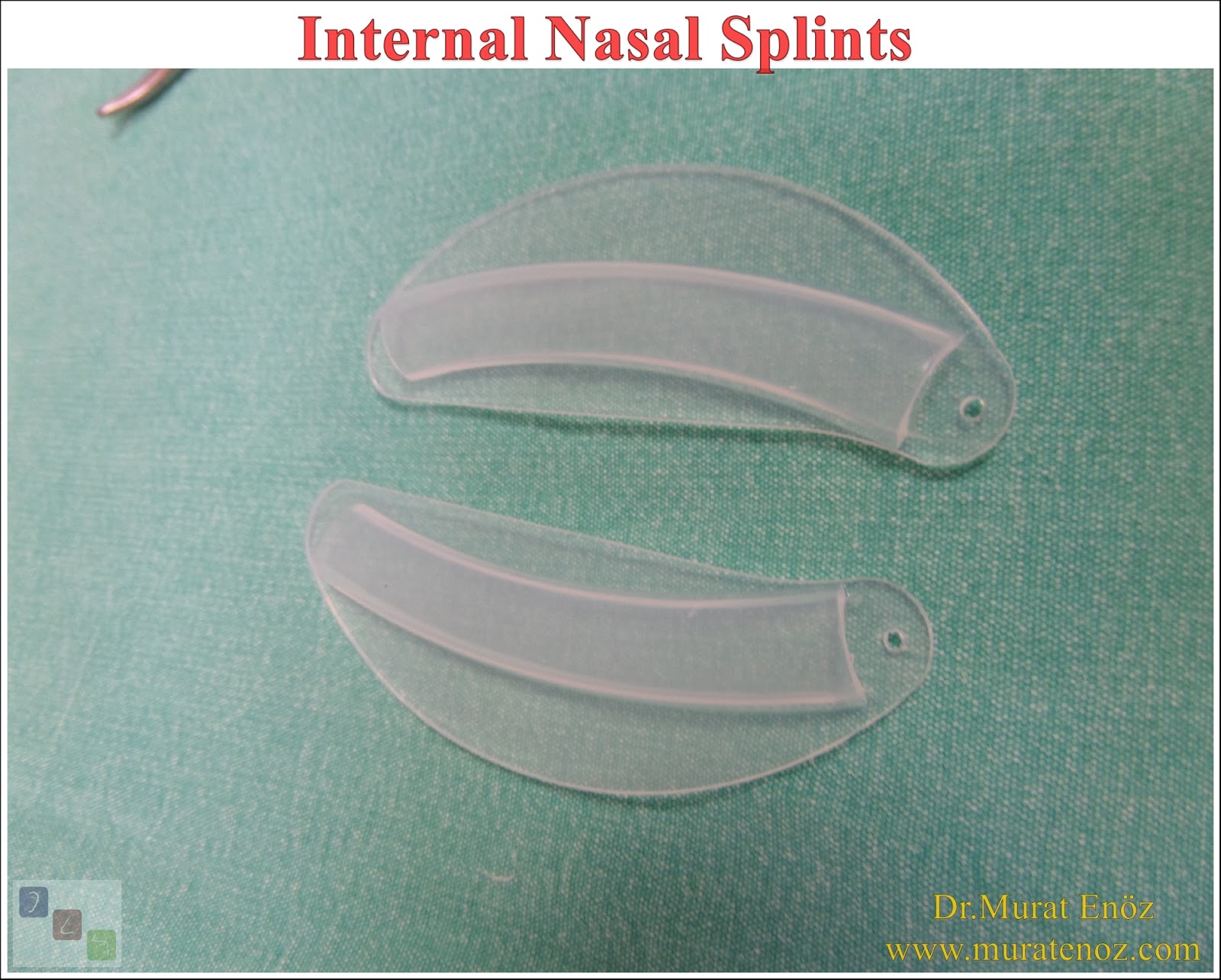 Advantages and Disadvantages of Internal Nasal Splints