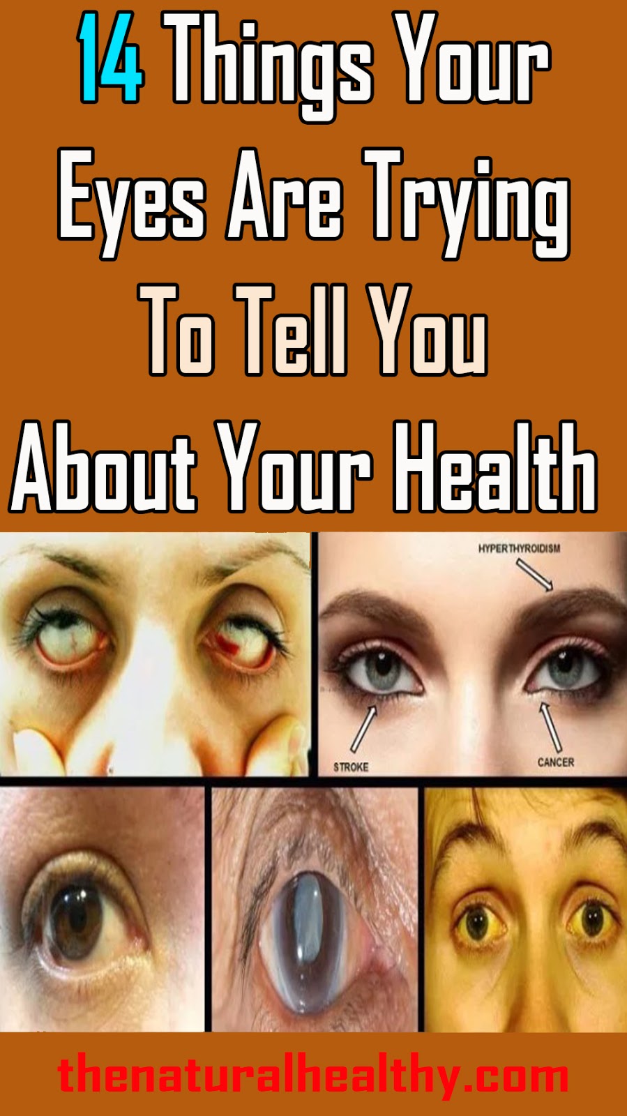 14 Things Your Eyes Are Trying To Tell You About Your Health