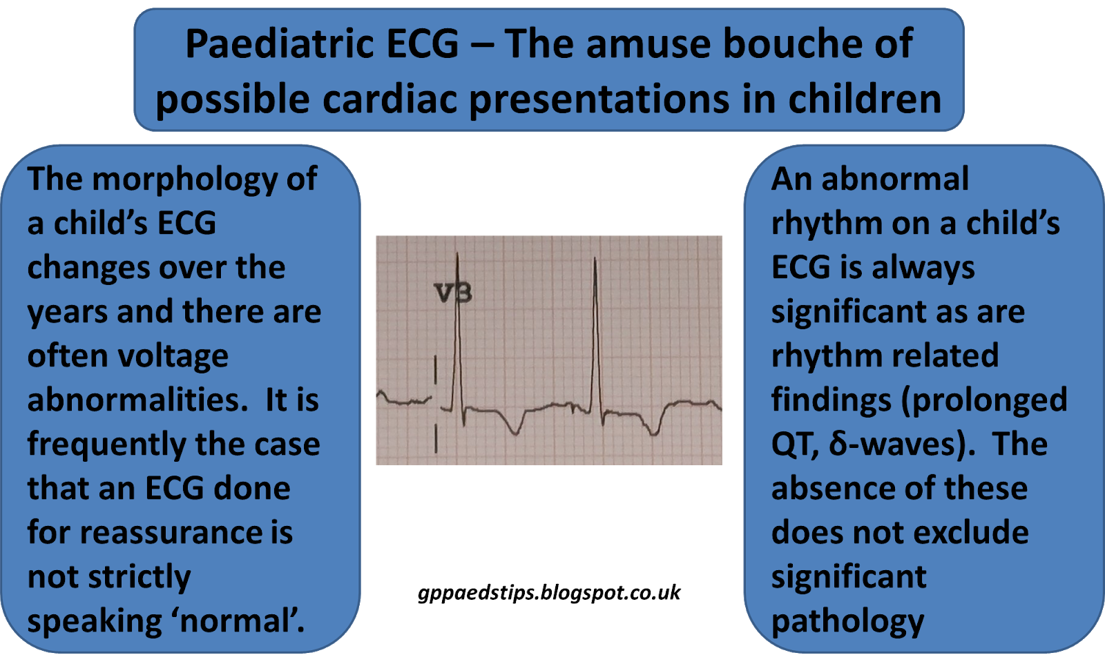 Paediatrics For Primary Care and Anyone Else ECG In Children An 