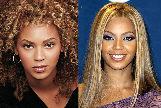Beyonce-%20before-after-plastic-surgery
