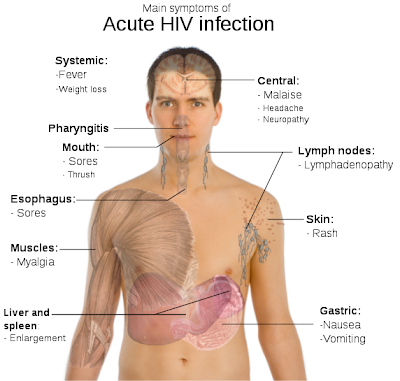 HIDUP MESTI DITERUSKAN: AIDS - FAKTA MENGENAI PENYAKIT