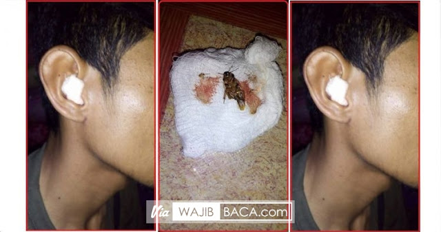 Periksa Kembali Jika Hendak Memakai Helm, Jangan Sampai Kejadian Ini Menimpamu