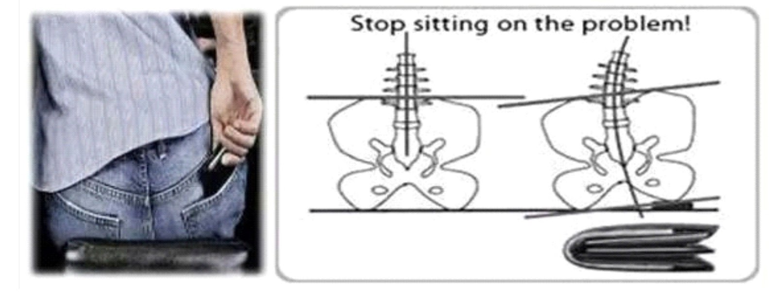 Orthopedic SelfCare VIROCHOSPITAL Sciatica (Nerve Pain from Hips to Heel)