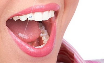 Piercing Dental: Odontología Moderna