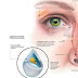 "Olho seco" ligado a síndromes de dor crônica