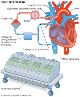 Student's Guide to Medical Technology: Heart-Lung Machine