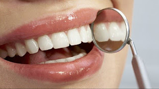 Observação dos dentes por um dentista - alimentos para boca