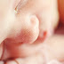 9 Cara Menghilangkan Biang Keringat pada Bayi yang Terbukti Ampuh