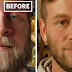 10+ Before-And-After Pics Show What Happens When You Stop Drinking