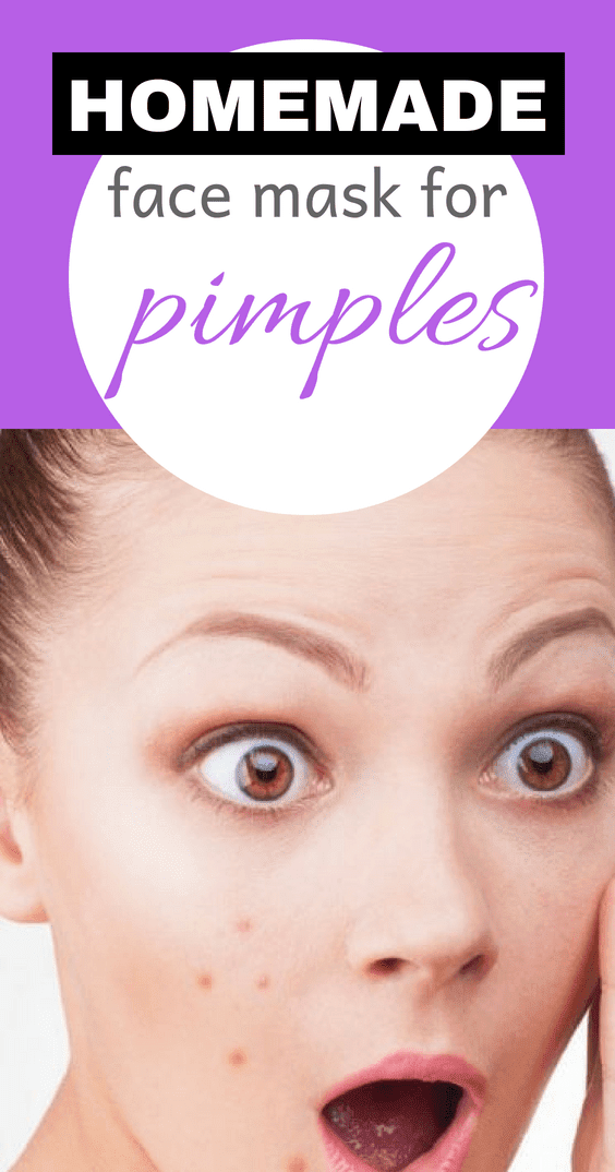 Homemade Face Mask For Pimples