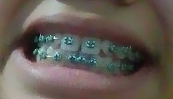 Bunga Wiladatika PENGALAMAN PAKAI BEHEL