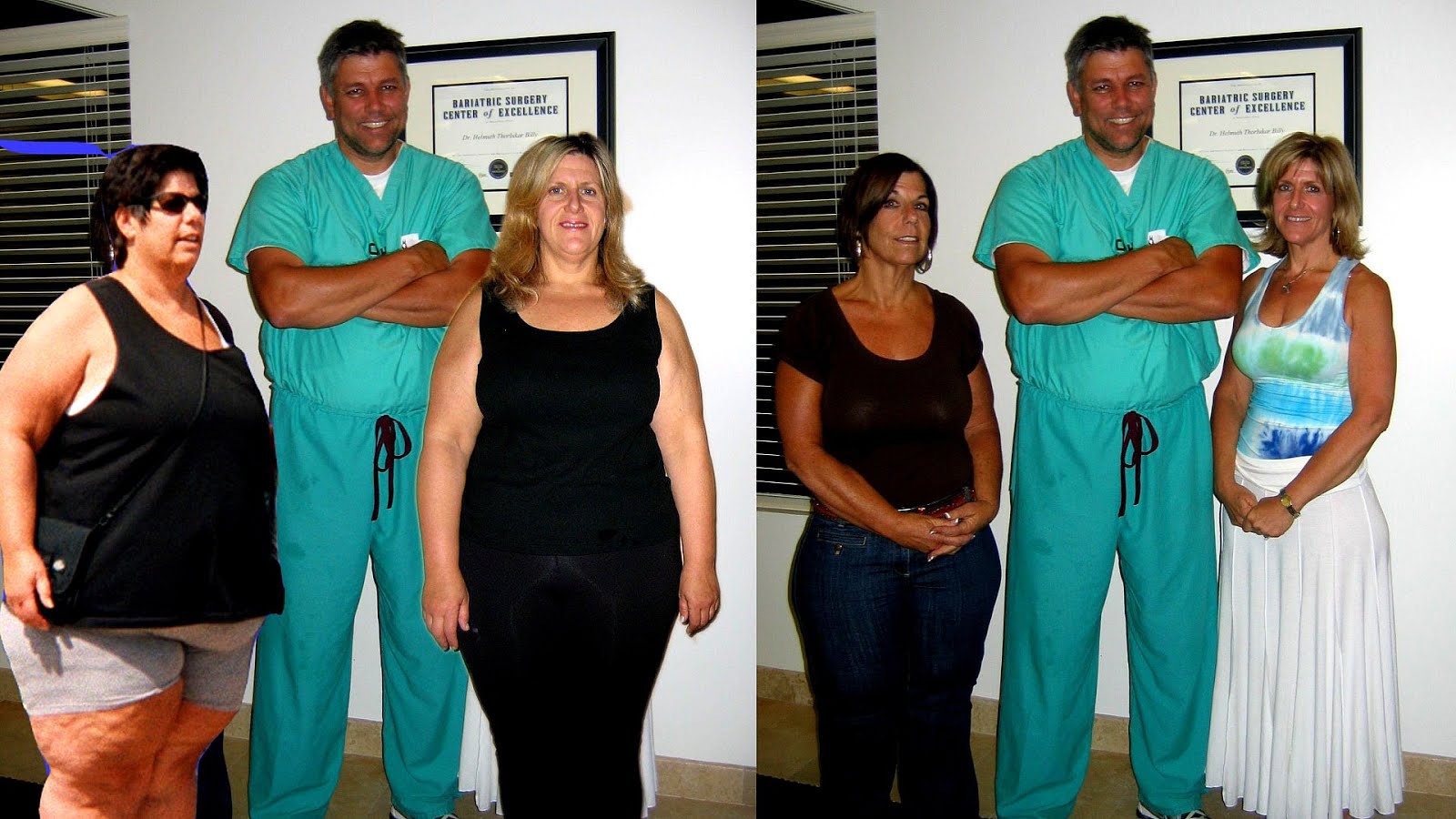 How Long Is Lap Band Surgery How Choices