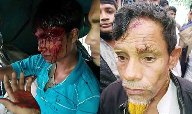 In Banshkhali, Jamaat candidate Mahmudul Islam was injured বাঁশখালীতে জাপা প্রার্থী মাহমুদুল ইসলামের গাড়ি বহরে হামলা, আহত ১০