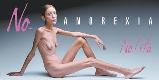 Isabelle Caro in billboard ad 'no anorexia'