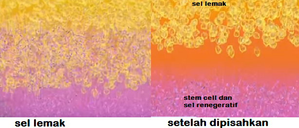 Proses stem cell