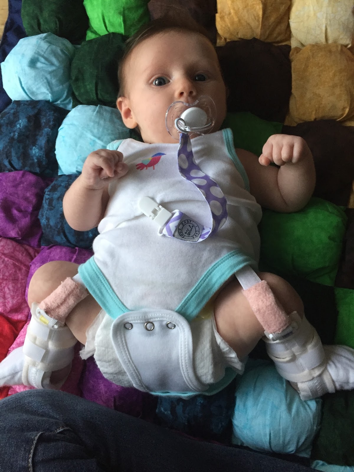 Handstands Hip Dysplasia and the Pavlik Harness Information and Help