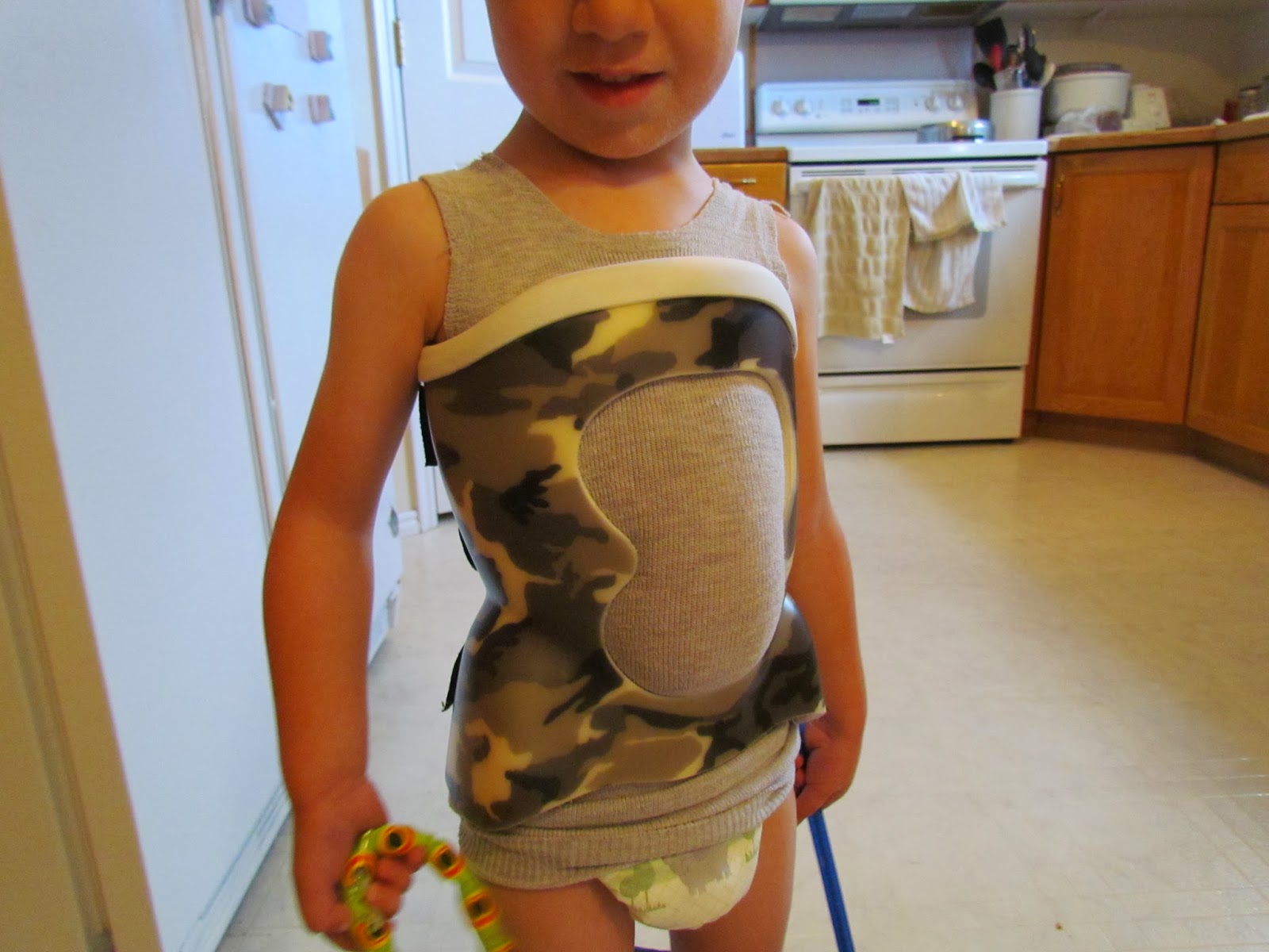 Our Journey through Progressive Infantile Scoliosis pictures of brace