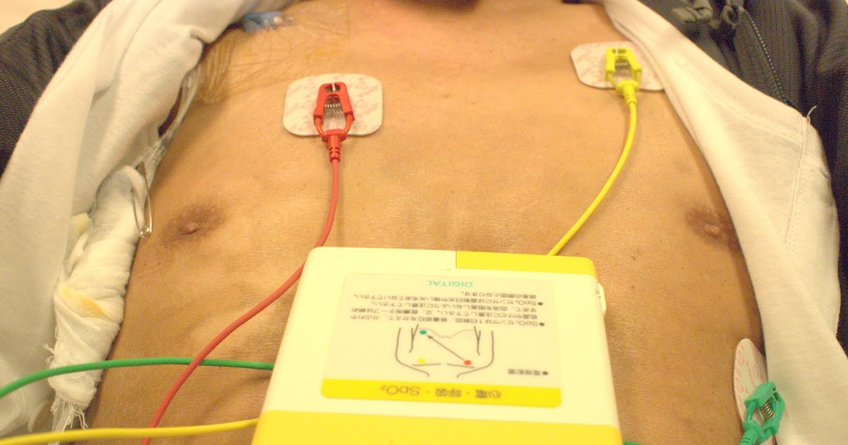 血液がん〖菌状息肉症〗 『ミニ移植～再発～サルベージ療法に期待して』 5月17日(木曜日) 曇りのち晴れ Day7