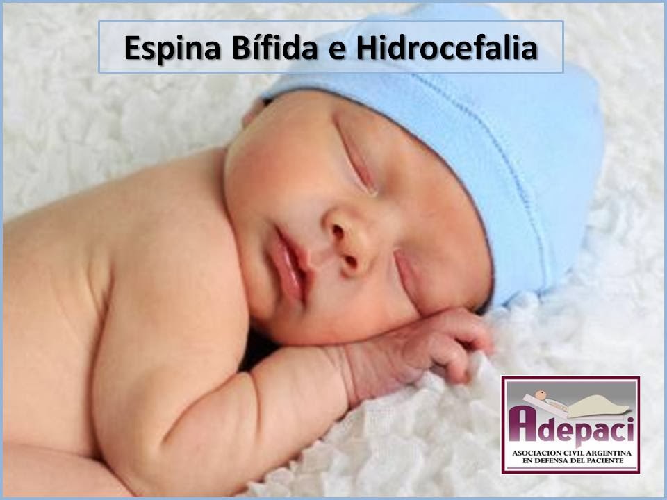 DERECHOS del PACIENTE Espina Bífida e