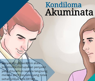kutil.JPG