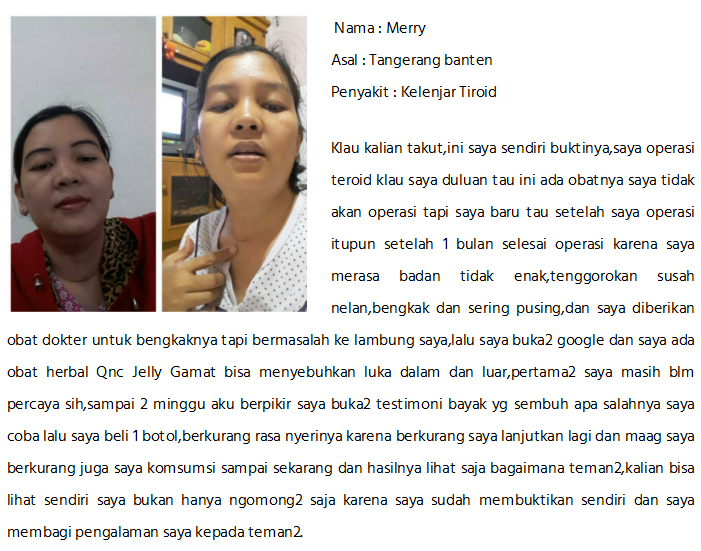 Cara Ampuh Menyembuhkan Tbc Kelenjar Sampai Sembuh Total Cara Menghilangkan TB Kelenjar Di Leher 100% Sampai Tuntas