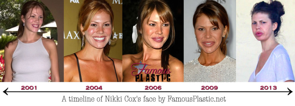 Chubby tgp the Nikki cox boob job