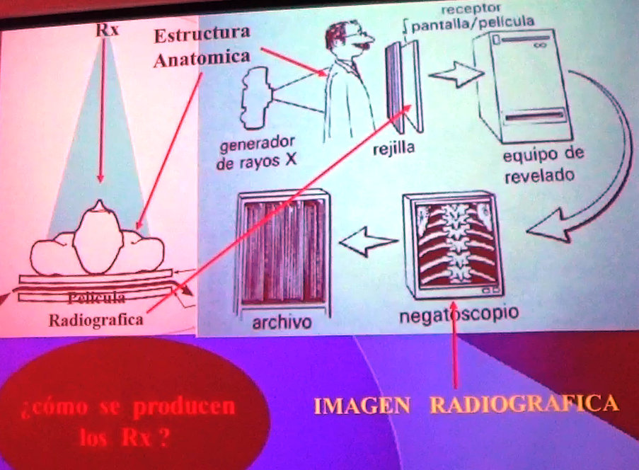 RADIOANATOMIA: PRIMERA CLASE DE RADIOANATOMIA