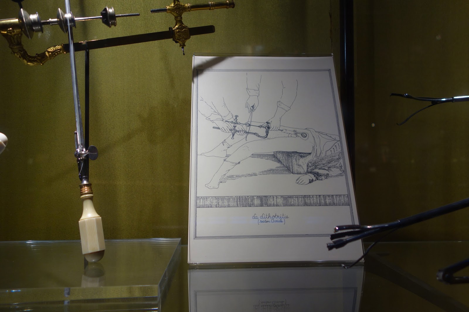 Musée d’histoire de la médecine, Paris